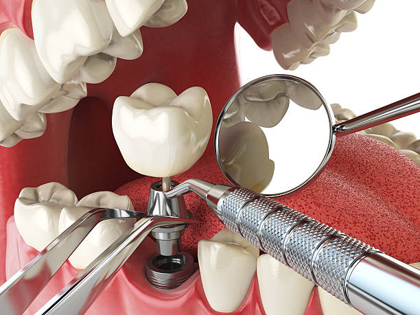 Best Emergency Orthodontic Repairs in Exeter, CA